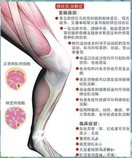 冰吻吉他谱